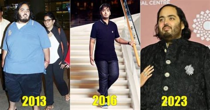 Anant Ambani's Health Update After Successful Surgery