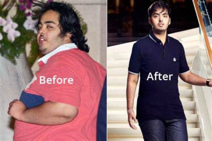 Revealing The Cause Behind Anant Ambani's Weight Gain: Unlocking The Truth