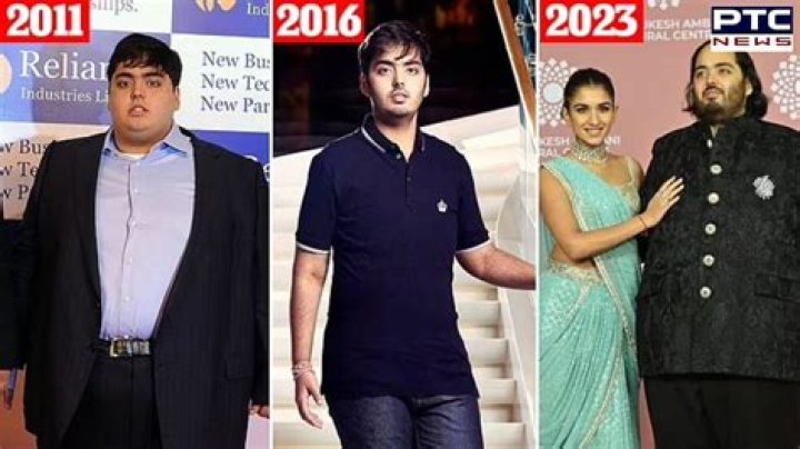 Understanding The Unique Challenges: Anant Ambani's Health Journey
