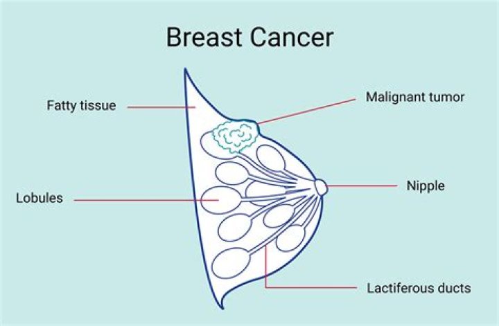 Is The Pioneer Woman Battling Cancer?