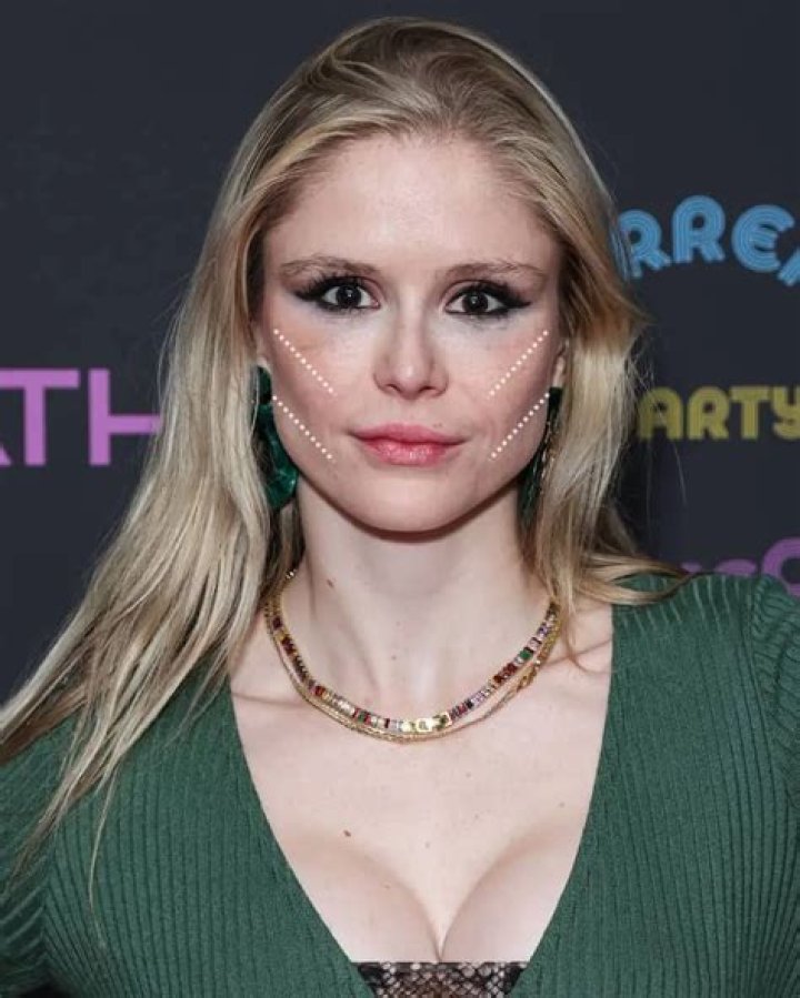 Discover The Secrets Of Erin Moriarty's Buccal Fat Transformation