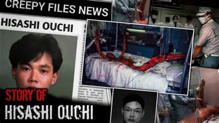 Hisashi Ouchi's True Tragic Story | Photo Uncovered