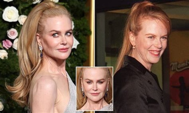 The Surprising Evolution Of Nicole Kidman's Look: Botox Or Natural Beauty?