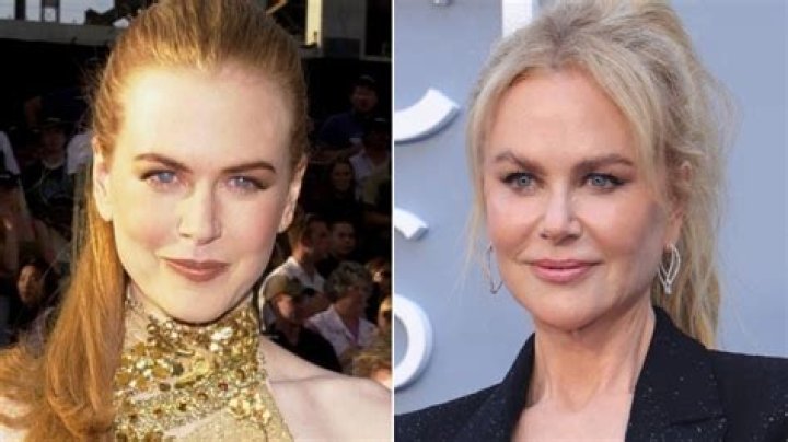 Kidman's Surgery: Details Unveiled