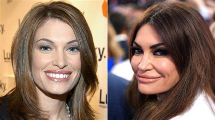 Kimberly Gilfoyle: A Transformation Before And After