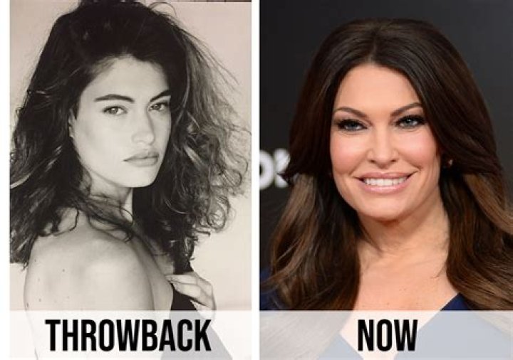 Unveiling Kimberly Guilfoyle's Transformation: Before And After Revealed