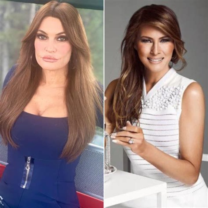 Kimberly Guilfoyle Transformation: Before And After Surgery