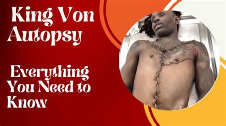 King Von Autopsy: A Shocking Look Into The Aftermath