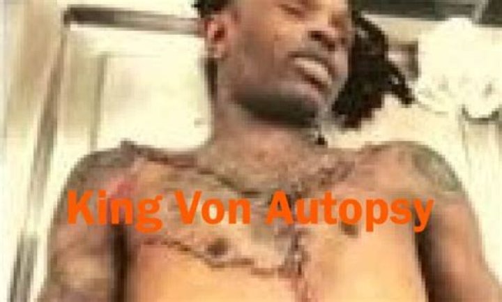 King Von's Autopsy: A Detailed Look Into His Tragic Death