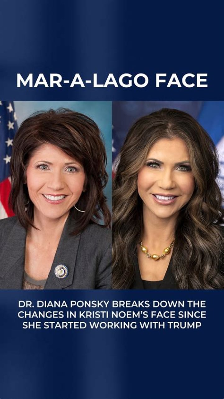 Curious About Kristi Noem's Pre-Surgery Appearance? See Photos Here