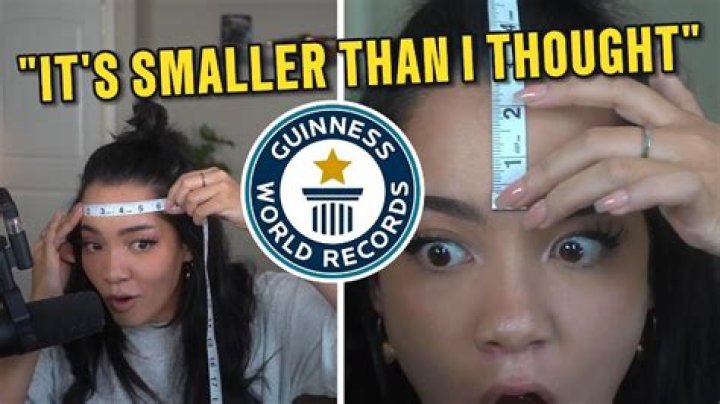 Discover The Secrets Behind The Largest Forehead In The World