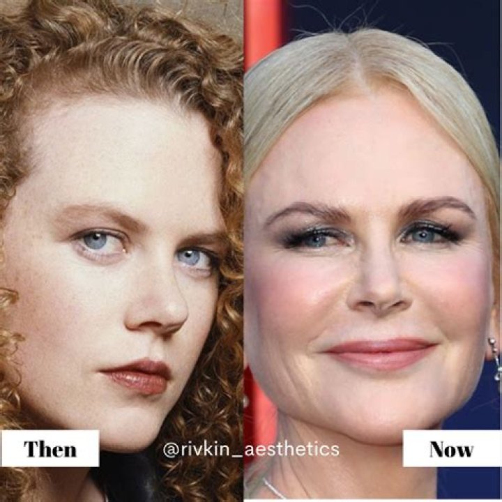 Nicole Kidman's Guide To Maintaining A Natural Look After Plastic Surgery
