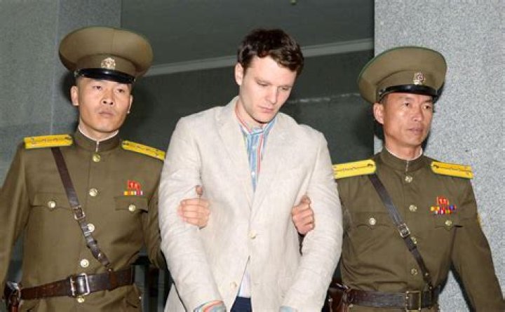 Otto Warmbier's Teeth: A Tragic Transformation