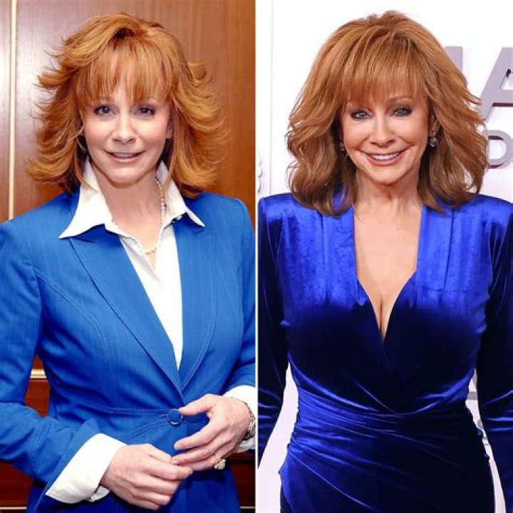 Unlock The Truth Behind Reba McEntire's Plastic Surgery Journey