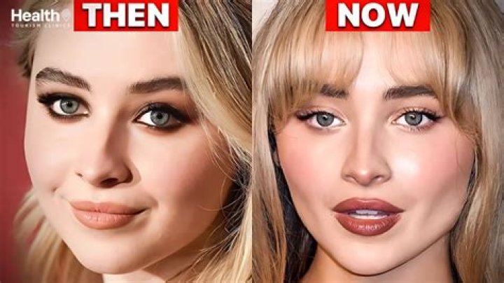 Sabrina Carpenter's Striking Transformation: Before And After