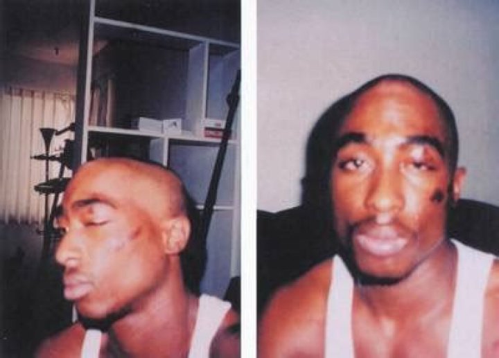 Unveiling Tupac's Gunshot Wounds: Discoveries And Insights
