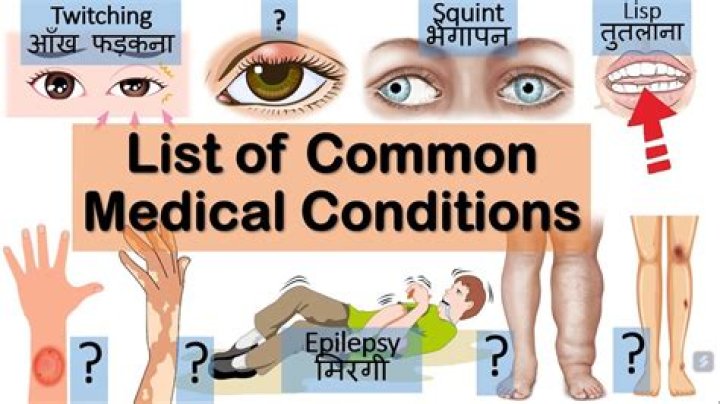 Understanding Robert Height's Medical Condition: Key Insights